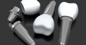 421_dental-implants-459-wide1-459x240